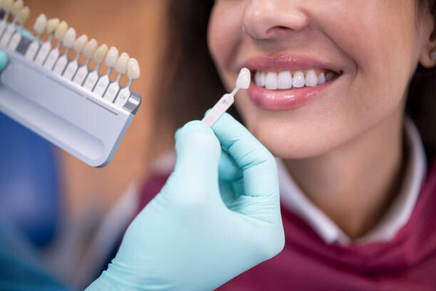 Levně Plakát, Obraz - Dentist using a palette tooth color sample., ArtistGNDphotography, 40 × 26.7 cm