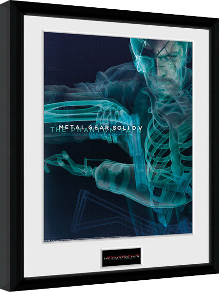 Framed Poster Metal Gear Solid V - X-Ray