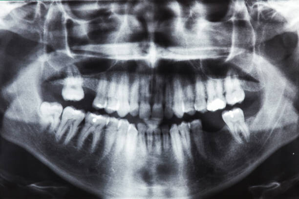 Umelecká fotografie Closeup x-ray image of teeth and mouth
