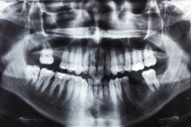 T-Shirt Closeup x-ray image of teeth and mouth