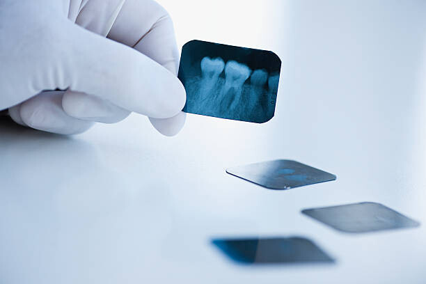 Billede på lærred Dental x-ray